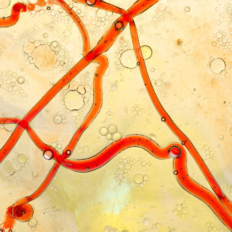 Abstract blood vessels